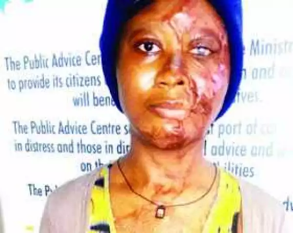 Jilted lover bathes ex-girlfriend with acid in Lagos (photo)